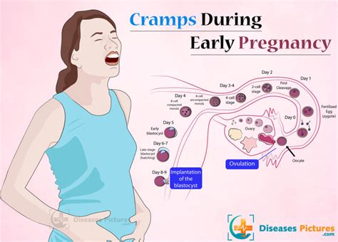 Are Cramps After Orgasim An Early Sign Of Pregnancy? Find Out Now!